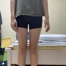 영머리방 | 상상의원 대구점 mpl 허벅지 1 회차 후기(내돈내산)
