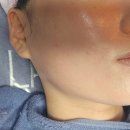 성산동 피부관리 마포구청역 웨딩케어 이모아에스테틱 트로이필 관리 솔직후기! 신부관리의 명가