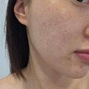 큐티뷰티 | 제목: 인셀라 큐티 프로, 얼굴부터 전신 탄력 관리까지 끝내는 뷰티 디바이스 솔직 후기