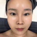 대남한의원 | 창원마산 미엘르지스킨 여드름 문제성 피부 윤곽 미백 올인원 관리