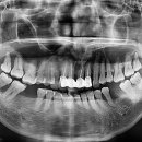 신플란트치과의원 이미지