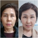 인셀덤부평