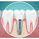 서울오름치과의원 이미지