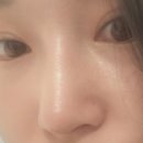 별 한말 | [내돈내산 후기] 정읍 코 필러 &amp; 보톡스 솔직후기 ✨