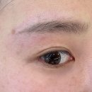 수원-1538 | 광교 브로우 [ 글로시 눈썹 광교점 ] 붉은기 잔흔 말끔히 없애기