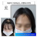 비앤에스 네이버블로그