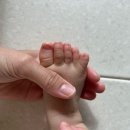 세븐일레븐 동국대제일병원점 | 대구 더블유병원(w병원) 다지증, 합지증 수술 입원 후기 1. 입원 준비 기간 및 준비물