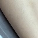 뷰티 썸 스킨 이미지