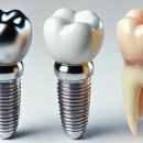 서울장플란트치과의원 이미지