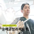 김형석외과의원 | 눈매교정 부작용 등 주의할 점, 헤링법칙이 뭘까요?