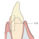 이75덴탈 이미지