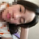 수다라떼 상담 | 이오스안과 스마일라식 후기 내돈내산 당일검사 당일수술 투데이라섹 일주일경과 비용