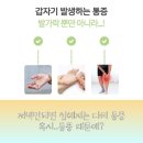 김앤정류마내과의원 | &#39;발가락 끝 통증이 지속된다면? 류마내과에서 진료받아보세요!&#39; [쇼그렌증후군 검사]