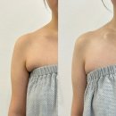 투유피부관리 | 천안 피부관리 불당동 뷰티투유 에스테틱 체형교정 팔뚝 승모근 관리