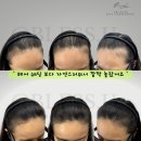 [ 수유 / 도봉역 ] 두피문신 업체에서 문제성 두피까지 해결되는 과정 (무료 상담⭕️)