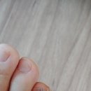 예인피부과의원 네이버블로그
