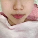 큐티 에스테틱 | 수유역피부관리 큐티도도아카데미 스킨플래닝, 하이푸리프팅관리 후기
