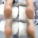 하이푸스 마포대흥점, 승무원 예비신부 구두 자주 신는 사람 발 관리, 공덕 발각질 관리 후기