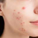 독     정 이미지