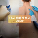 서울숲봄정신건강의학과의원 | 대구 점 빼기 쥐젖 제거 성지, 아들이 또 점을 빼러 간 이유는?
