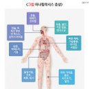 아나필락시스 쇼크 증상 원인 알레르기 피부 이미지