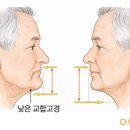 신화치과의원 | 광산구치과 전체 임플란트, 알고 있으신가요?