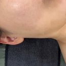 청주 에스테틱 &lt;예쁘지유 스킨앤바디&gt; 피부관리 후기