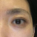 어썸2 | [왕십리 왁싱, 눈썹 왁싱] 어썸미뷰티 왁싱 2년 단골 후기 내돈내산