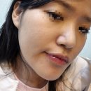 수내3동행정복지센터 | [성남/분당] 여드름피부관리 전문샵 &#34;동안피부&#34;에서 성인트러블 관리받은 후기