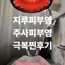 자유한의원 | 지루피부염 주사피부염 극복 꿀팁+한의원 치료 후기