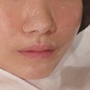리뉴메디스킨 | 광주 피부관리 데자뷰메디스킨 광주 속건조 홍조 피부 후기