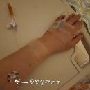 빛고을생생병원 | 걱정보다 괜찮았던 수술 이야기-빛고을여성병원 자궁근종개복술 후기