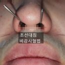 올치한의원 | 오른쪽이나 왼쪽 한쪽 귀가 울리는 이명증상의 원인과 치료법 - 이명치료(수원이명한의원)
