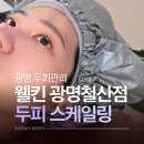 광명노인건강케어센터 | 광명두피관리 웰킨두피탈모센터 광명철산점 개운한 스케일링 후기