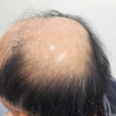 김호증모가발대구체인헤어슈