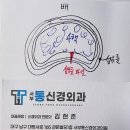 추신경외과의원 | 허리디스크, 섬유륜파열, 디스크내장증 예방법 [서부통신경외과] 대명동, 상인동, 송현동, 월배 야간진료