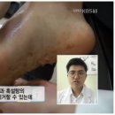 푸스올 이미지