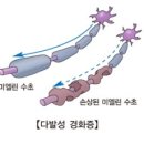 경화 이미지
