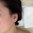 원뷰티스킨케어홍성 | 홍성 내포피부관리 원뷰티 이지다 홍성내포점 이지샷케어 후기