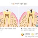 안산서울그레이스치과 네이버블로그