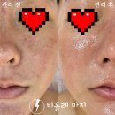 옥정 찐피부관리 맛집 / 물광관리 꿀조합패키지 / 옥정비올레마지
