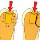 참치과기공소 이미지
