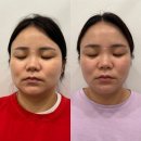 레티나메디칼 | 스킨부스터 대신 청주 슈퍼젝션 전문점, 수드림에스테틱