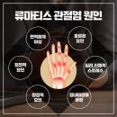 신선식 | 류마티스 관절염에 좋은 음식 vs 나쁜 음식 총정리! 관리 노하우까지 공개