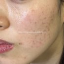 트레이닝타임 | 시흥목감피부관리 스킨트레이닝센터 트러블피부 관리 후기