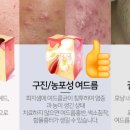 바라봄피부과 이미지