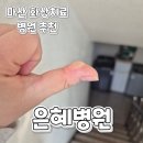 은혜약국 | 창원화상치료후기)마산 은혜병원 2도 화상치료 및 셀프 화상 치료 후기