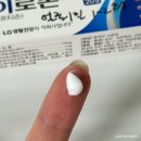여름 피부 오돌토돌 가려움 건조 붉은기 붉어짐 약 연고