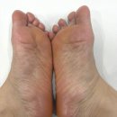 뷰티샵 | [의정부] 발 각질 이렇게 달라진다고?” 의정부 에스뷰티샵 솔직 후기