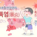 아프닥